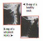 whip08.jpg (7444 bytes)